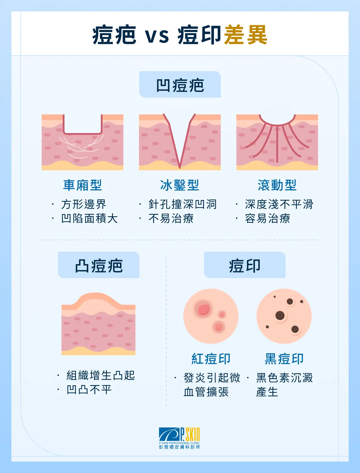 痘疤 vs 痘印差異