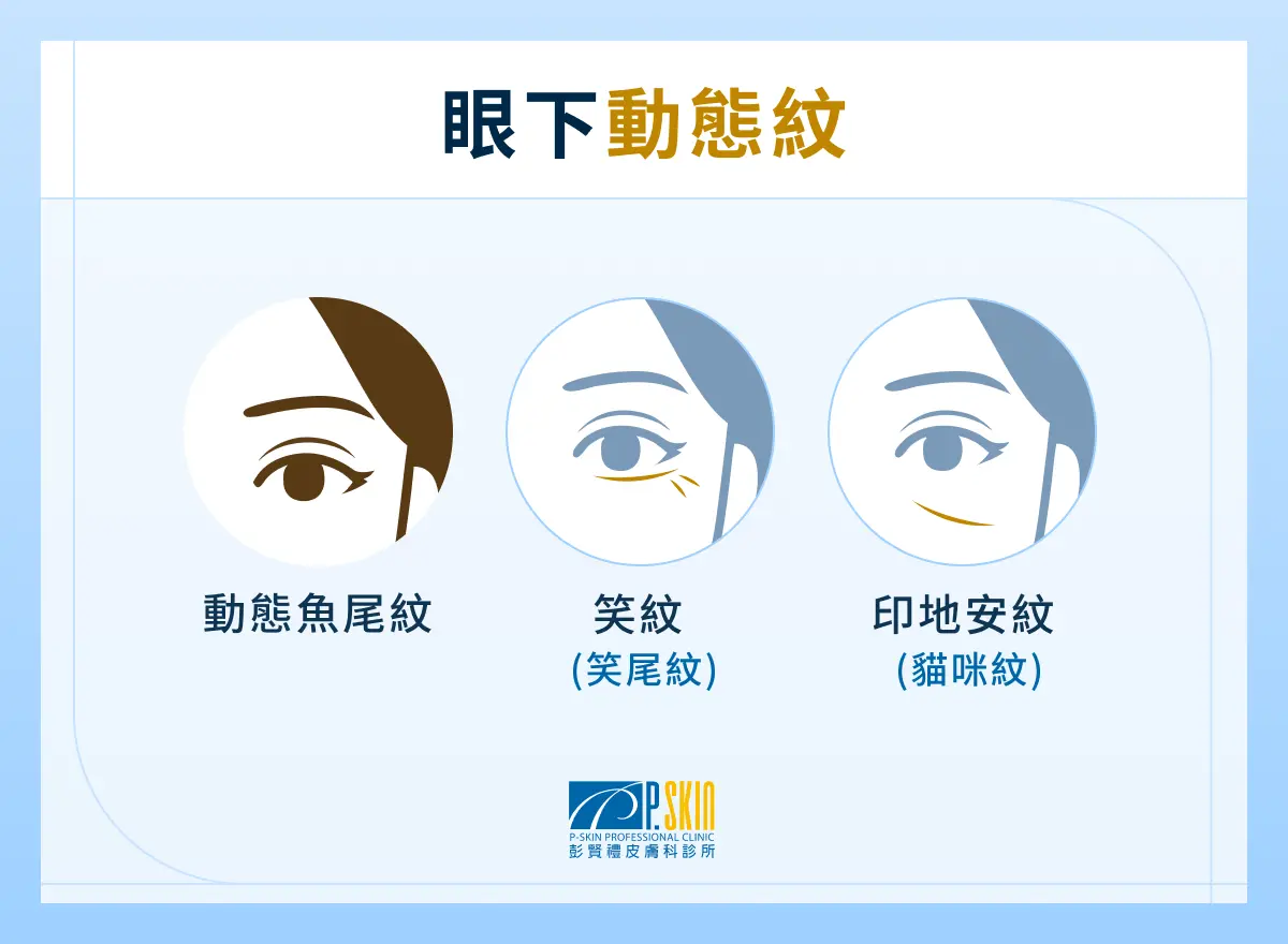 眼下動態紋