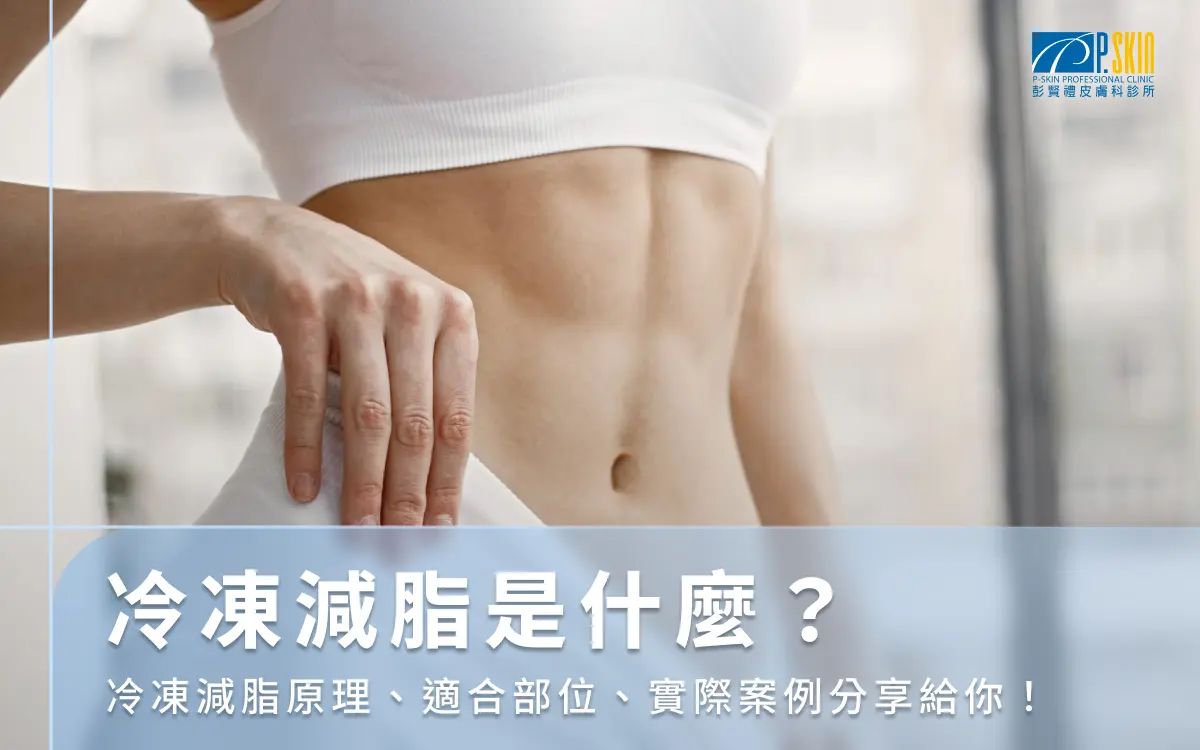 冷凍減脂是什麼？冷凍減脂原理、適合部位、實際案例分享給你！