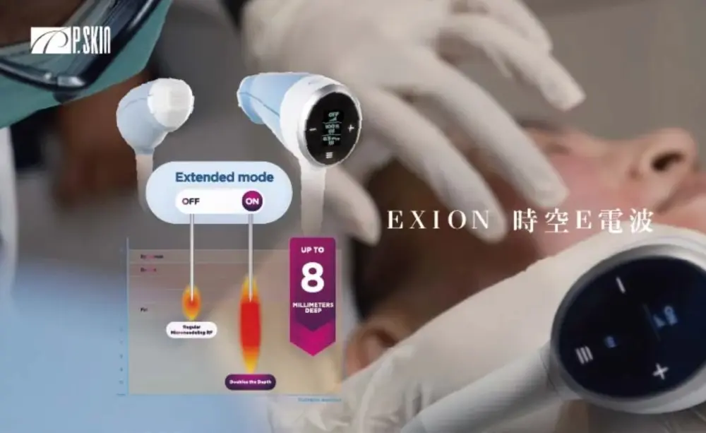 時空 E 電波 EXION